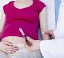 Norma fibrinogen tijekom trudnoće, a izaziva protein abnormalnosti