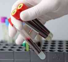 Opće krvni test za HIV: imenovanje i promjene parametara