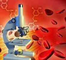 Opće i biokemijska analiza krvi. prijepis