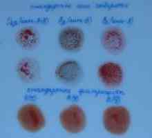 Krvna grupa i Rh faktor putem Colyclons