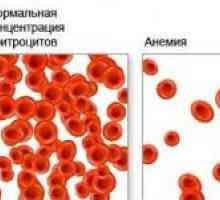 Glavni uzroci anemije