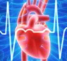 Glavni uzroci srčane aritmije