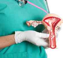 Glavni simptomi i tretman endometrija polipa