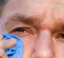 Pogotovo alergijske edem oči