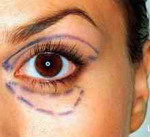 Značajke transkonjuktivne Blefaroplastika oka