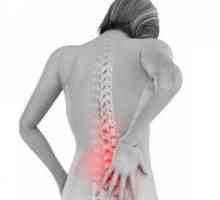 Osteochondrosis i njen utjecaj na krvne opskrbe: uzroci i simptomi bolesti, dijagnoza, liječenje,…