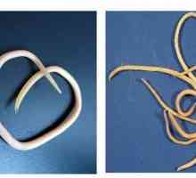 Pinworm i roundworm razlika: postupci liječenja infekcije i