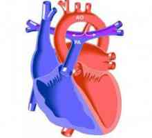 Otvoreni arterijski arterijski kanal (CAP): uzrokuje rascjep u djece, simptomi, kako se postupa