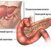 Pankreatitisa: patogeneze, simptoma, liječenje