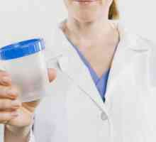 Paraziti u urinu: Vrste i liječenje