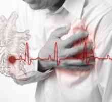 Prvi znakovi srčanog udara kod muškaraca. Simptomi bolesti.
