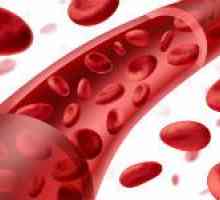 Zašto praska krvne žile u tijelu, i što učiniti