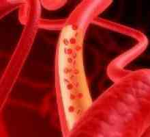 Kako ojačati krvne žile?
