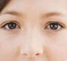 Što uzrokuje oticanje oko očiju i kako da biste dobili osloboditi od njih brzo