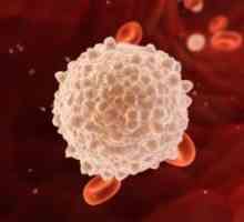 Zašto povećani bijele krvne stanice u krvi - uzroci i liječenje leukocitoza