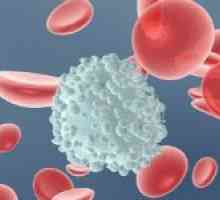 Zašto leukocitoza razvija u trudnoći i što učiniti