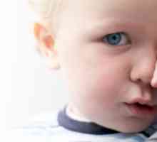 Zašto bebe vrećice ispod očiju i kako liječiti