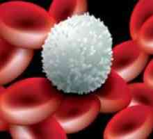 Zašto malo krvi leukociti