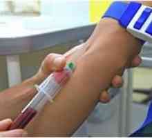 Pripravak za prolaz krvni test za hormone štitnjače