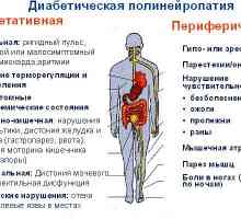 Polineuropatija: dijabetičku niži udova, alkohol (toksični) i druge