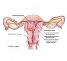 Polipi i endometrioza: što je ispunjen s ovom kombinacijom?