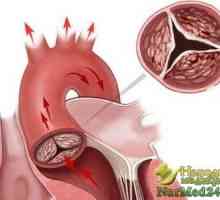 Pomoć narodnih lijekova u liječenju aortne stenoze u djece i odraslih