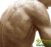 Pomoć u liječenju teških znojenje