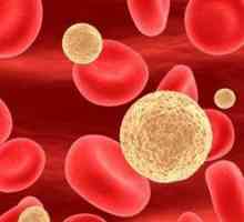 Smanjene razine bijelih krvnih stanica