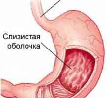 Površina gastro - simptomi i tretman
