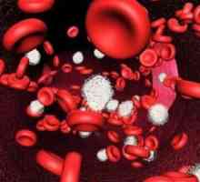 Promovira ICSU u analizi krvi: glavnih uzroka povreda.
