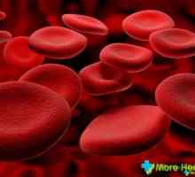 Što znači lošu analizu krvi i kako se boriti protiv?