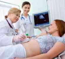 Povećana testosteron tijekom trudnoće