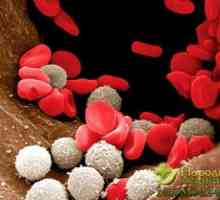 Leukocitoza razlog - prisutnost upale u tijelu, liječi se narodnih lijekova