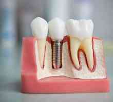 Uzroci i liječenje edema nakon ugradnje zuba