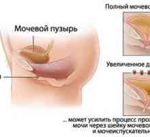 Uzroci urinarne inkontinencije kod menopauze