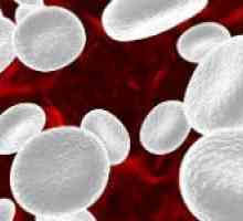 Razlozi za povećanje krvnih monocita