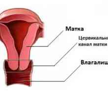 Uzroci grlića maternice u žena u postmenopauzi