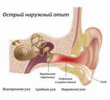 Uzroci simptomi i liječenje upale srednjeg uha uha
