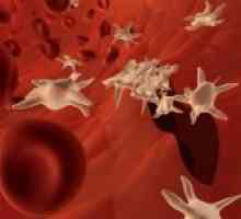 Razlozi za pad trombocita u krvi i povećati njihovu