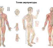 Primjena akupunkture
