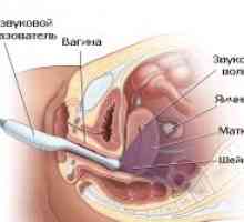Primjena ultrazvuka u Gynecology