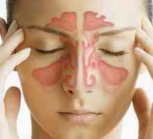 Znakovi i simptomi sinusitisa