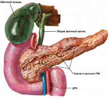 Znakovi i simptomi pankreatitisa kod žena