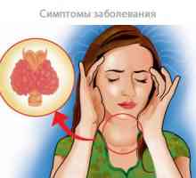 Znakovi i simptomi bolesti štitnjače u žena