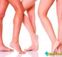 Simptomi proširenih vena nogu: kako ga spriječiti?