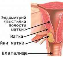 Rak vrata maternice