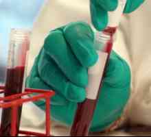 Dekodiranje glavne pokazatelje kemije krvi osobe