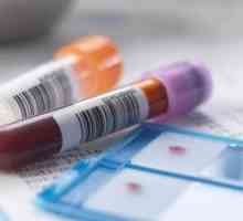 Dešifriranja biokemijske analize parametara u krvi kod djece