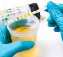 Objašnjenje sulkovicha uzorak: kalcij norma u urinu i uzrokuje odstupanje