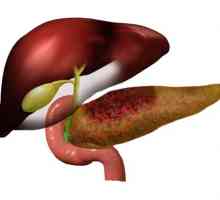 Je li dopušteno jesti jagode u pankreatitis?